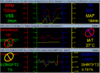 fuel trims maxed 16.36 at WOT-untitled.png